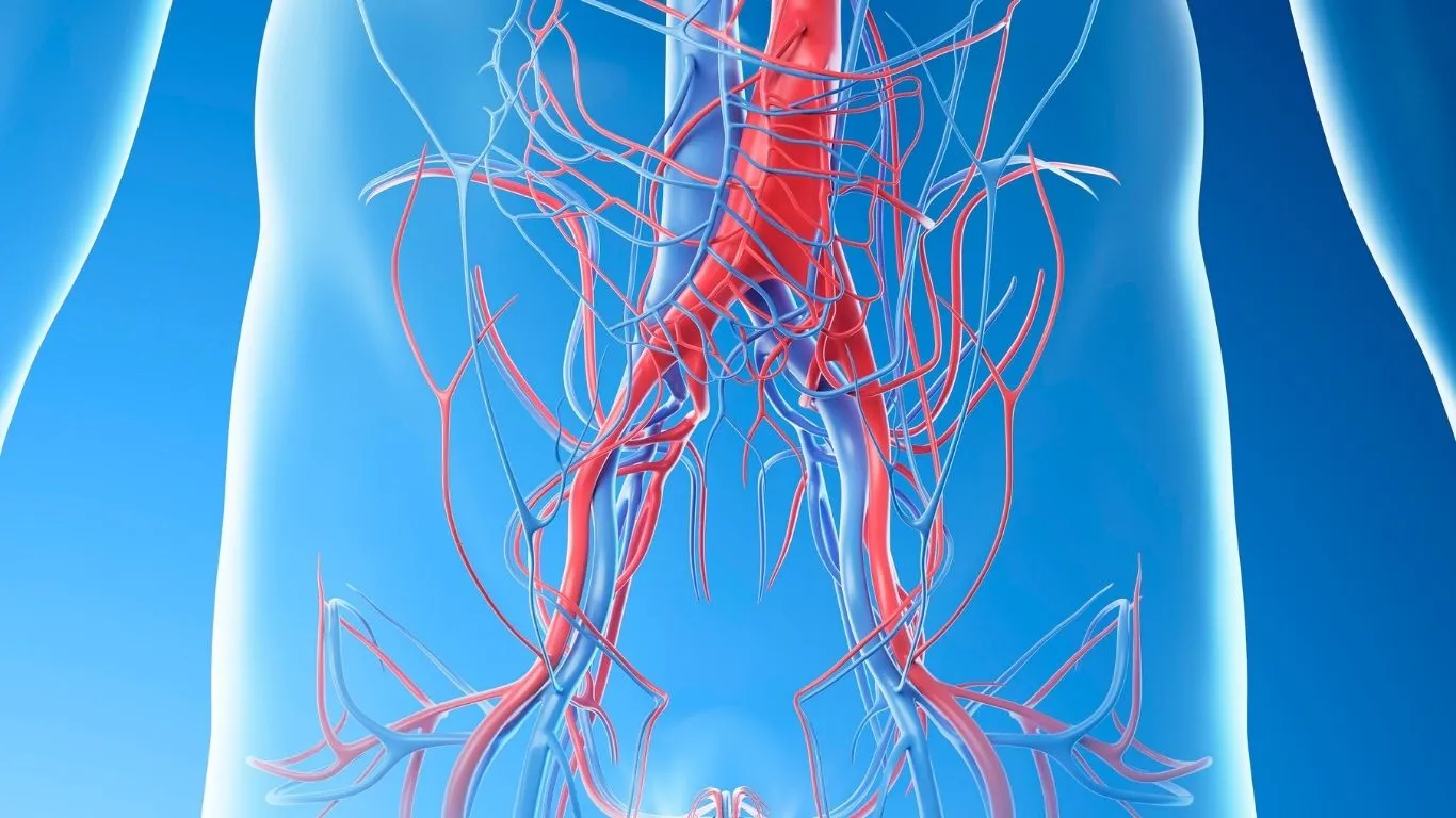 Abdominal Aortic Aneurysm