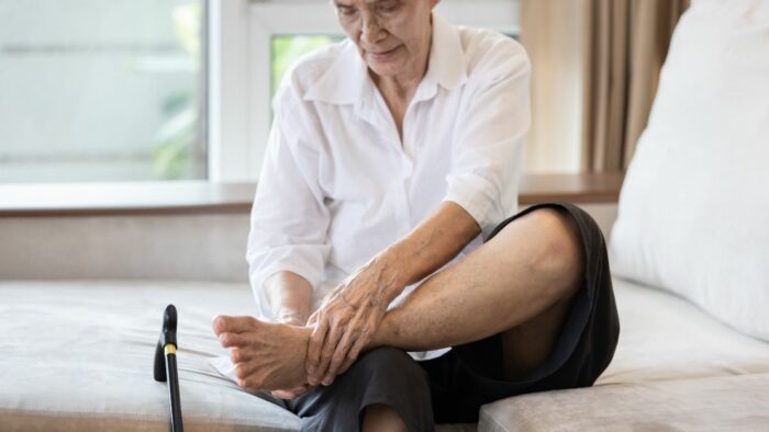 Peripheral artery disease